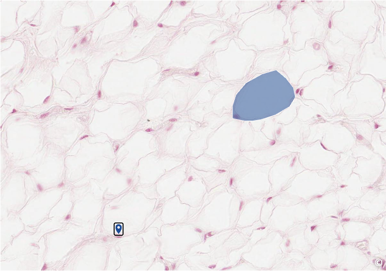 <p>identify area of histological slide, type of CT, and identify structures</p>