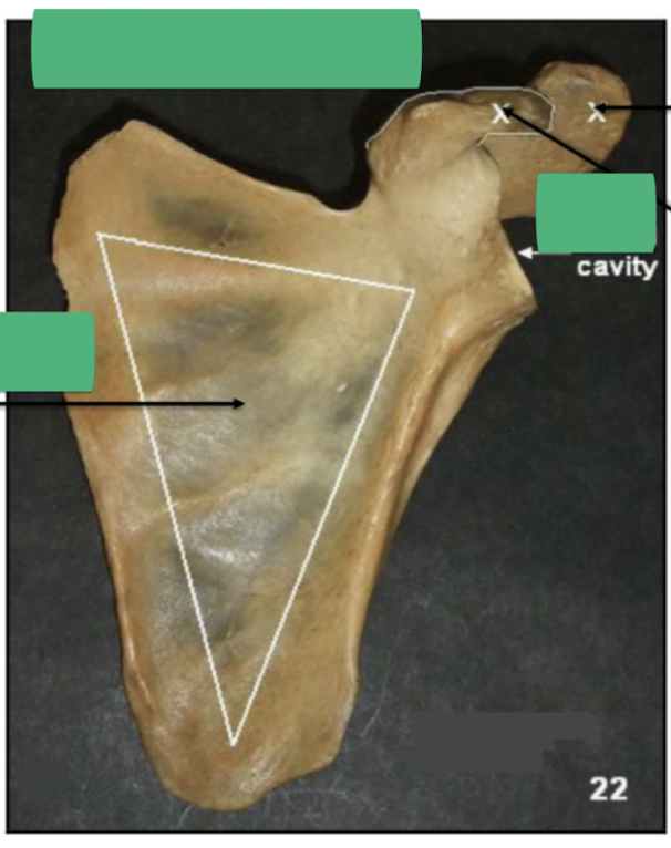 <p>what bone is this (+side) </p>