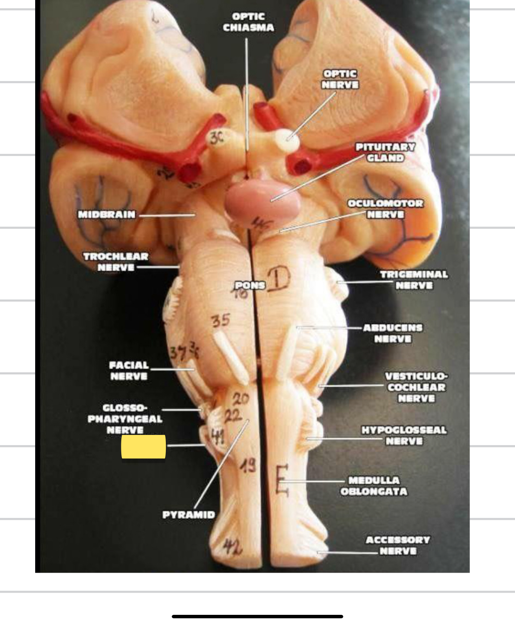 <p>Name this cranial nerve&nbsp;</p>