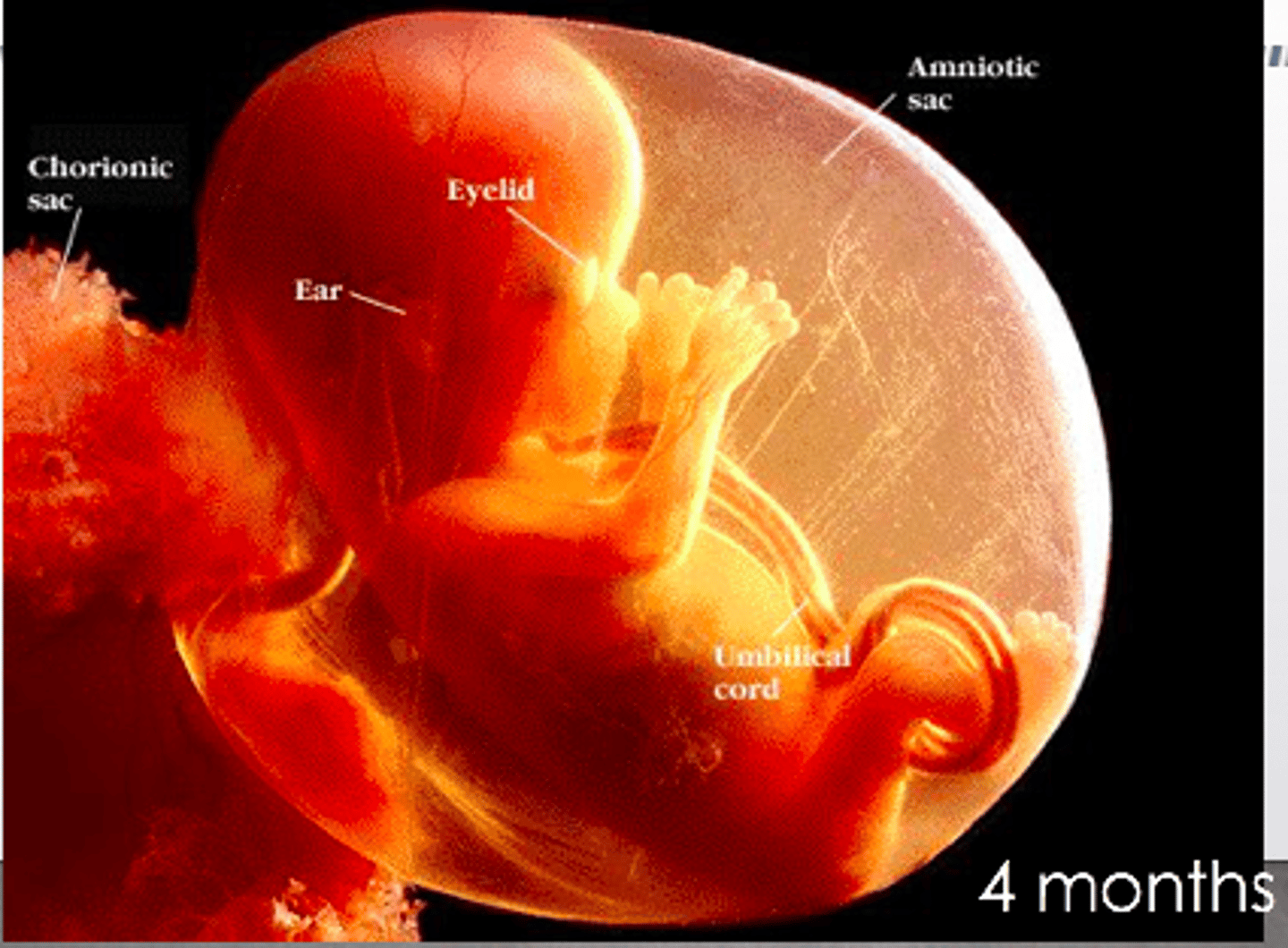 <p>The baby's gender might be detectable at a mid-pregnancy ultrasound, which is generally done between 16 and 20 weeks into pregnancy.</p>