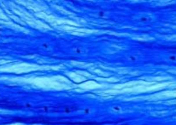 <p>Fibrous (cartilage) </p>