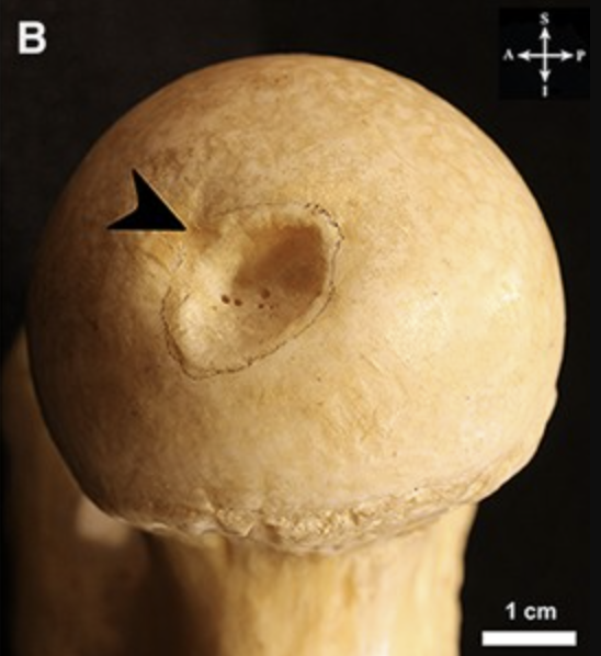 <p>Name this indentation on the bone.</p><p>(Found on the head of the femur).</p>