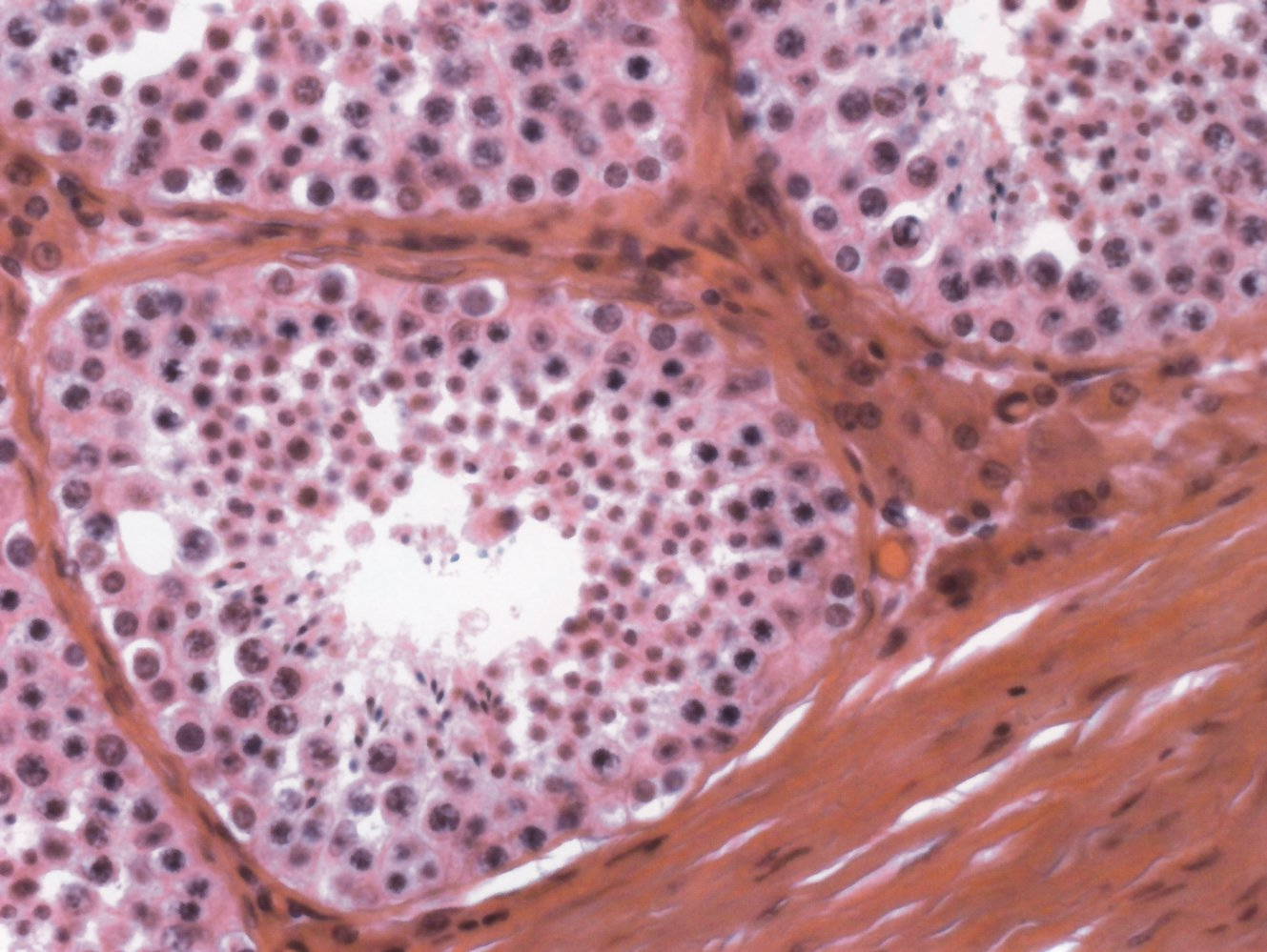 <p>C. Germinal epithelium of the testis</p>