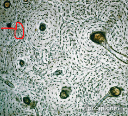 <p>what type of lamellae is this</p>