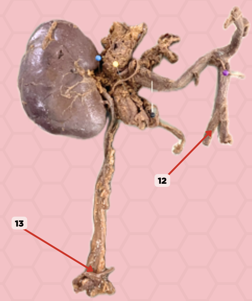 <p>Identify the structure labeled as 13.</p>