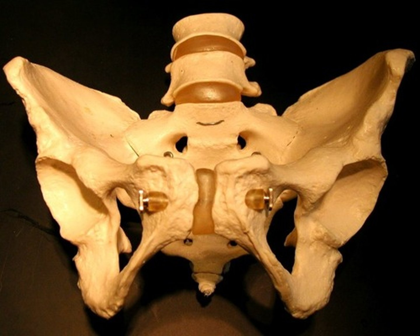 <p>Identify the sex of this pelvis</p>