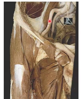 <ul><li><p>internal iliac artery</p><ul><li><p>towards the pelvic region</p></li><li><p>more medial</p></li></ul></li><li><p>external iliac artery</p><ul><li><p>towards the lower limb</p></li><li><p>more lateral</p></li></ul></li></ul><p></p>