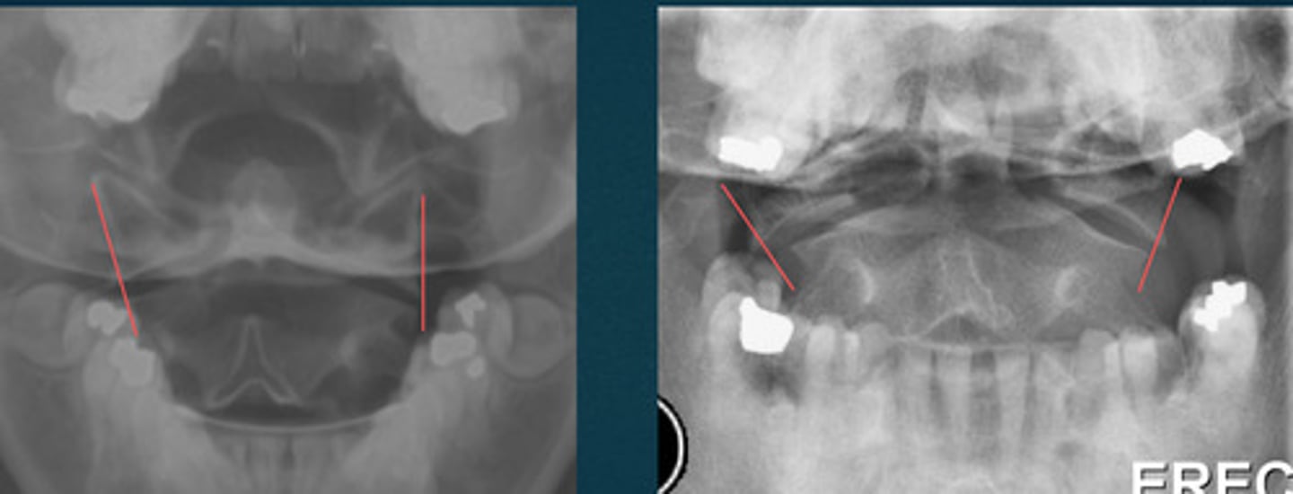 <p>What line of mensuration is this?</p>