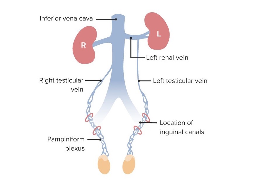 la vena testicular derecha drena hacia la __________