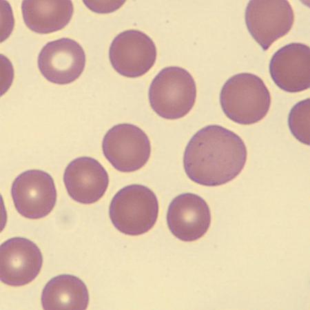 <p>What do these erythrocytes show?</p>