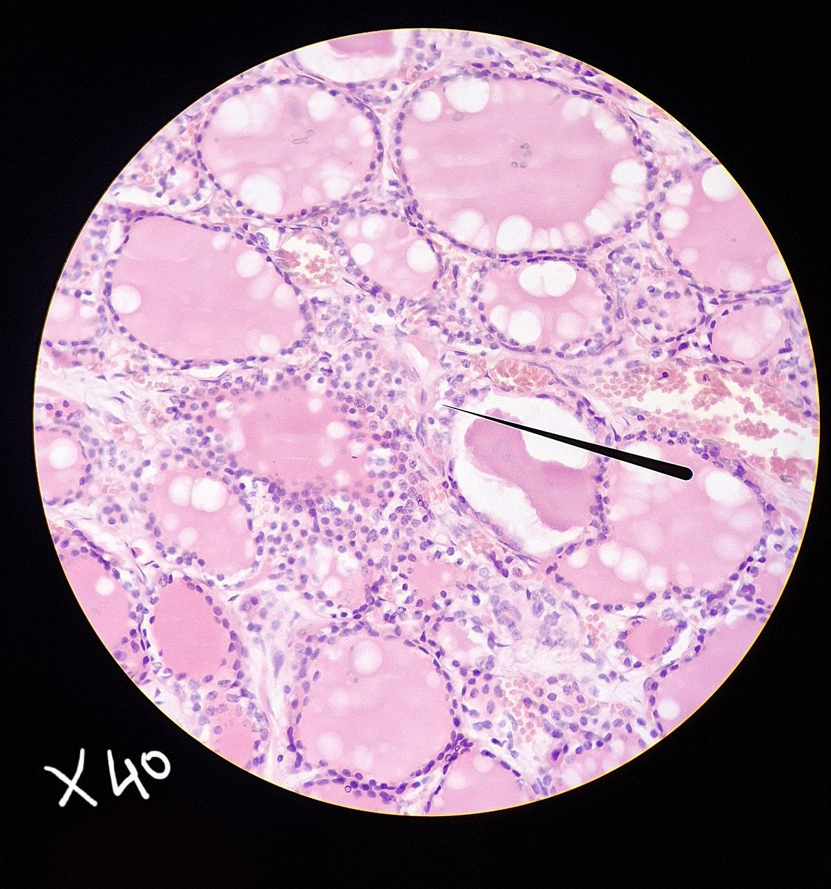 <p>Identify the tissue and mention one site</p>