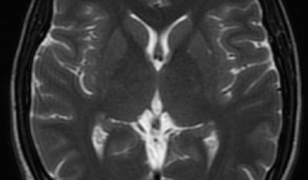 <p><span><mark data-color="green">Magnetic Resonance Imaging:</mark> uses a strong magnetic field and radio waves to generate detailed images of the inside of the body.</span></p>