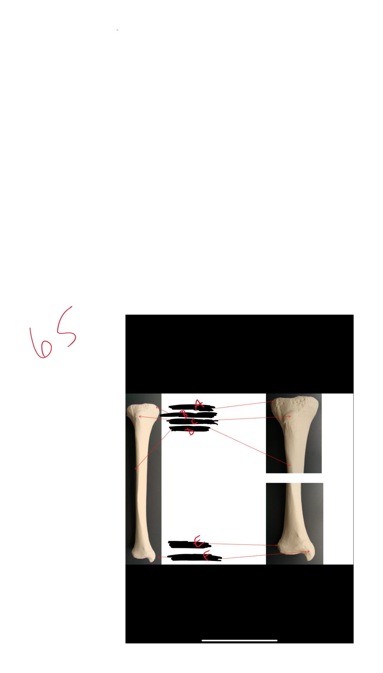 What is the bone?