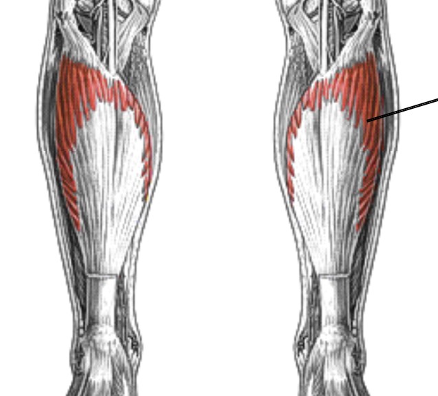 <p>Which muscle of the foot/ankle is:</p><ul><li><p>On posterior tibia</p></li><li><p>Deep to gastrocnemius</p></li><li><p>Action: plantarflex ankle</p></li><li><p>Nerve: <span style="color: yellow;"><span>tibial</span></span></p></li></ul><p></p>