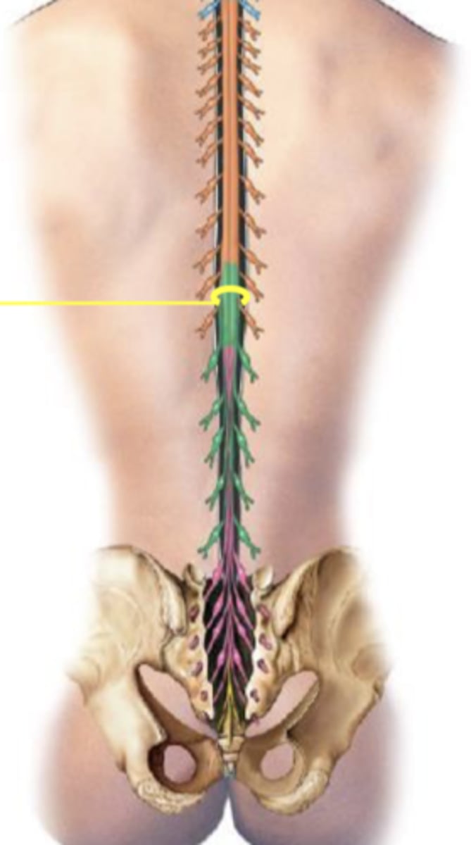 <p>nerves that supply lower limbs</p>
