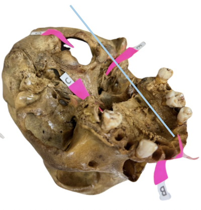 <p>Identify the structure of the skull labelled as B.</p>