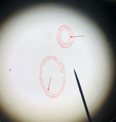 inner layer