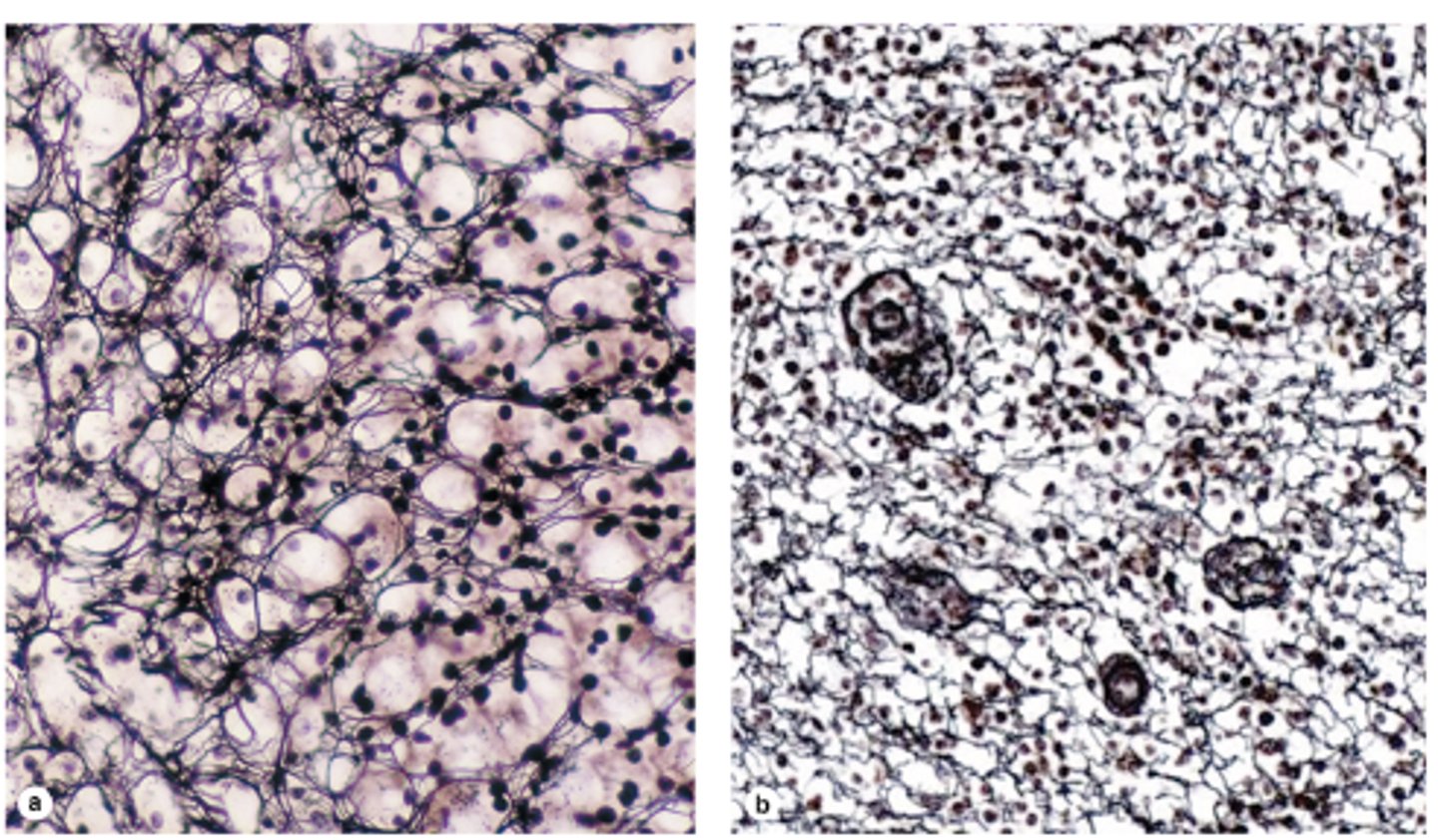 <p>How do Type III collagen fibers appear with silver impregnation preparations?</p>