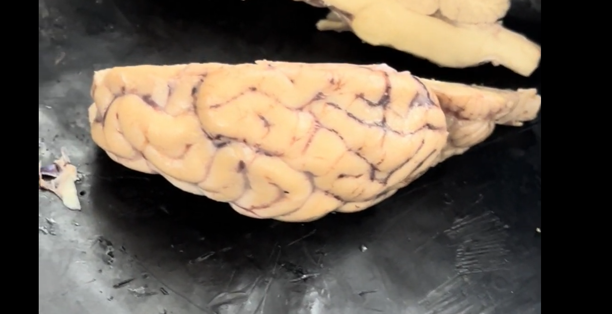 <p>What is the clear, shiny membrane on the surface of the brain called?</p>