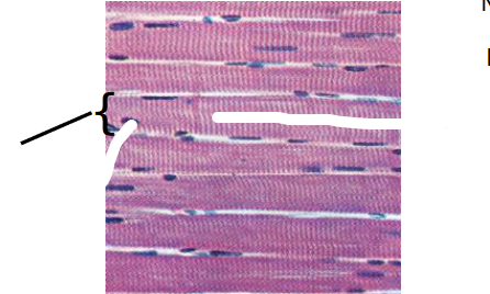 <p>What type of skeletal muscle tissue is this?</p>