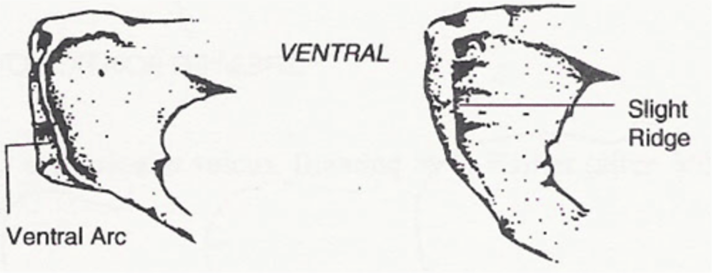 <p>a technique used to determine the biological sex of someone, they look at the ventral arc, subpubic cavity, and medial face. visual way of sexing the pubis</p>