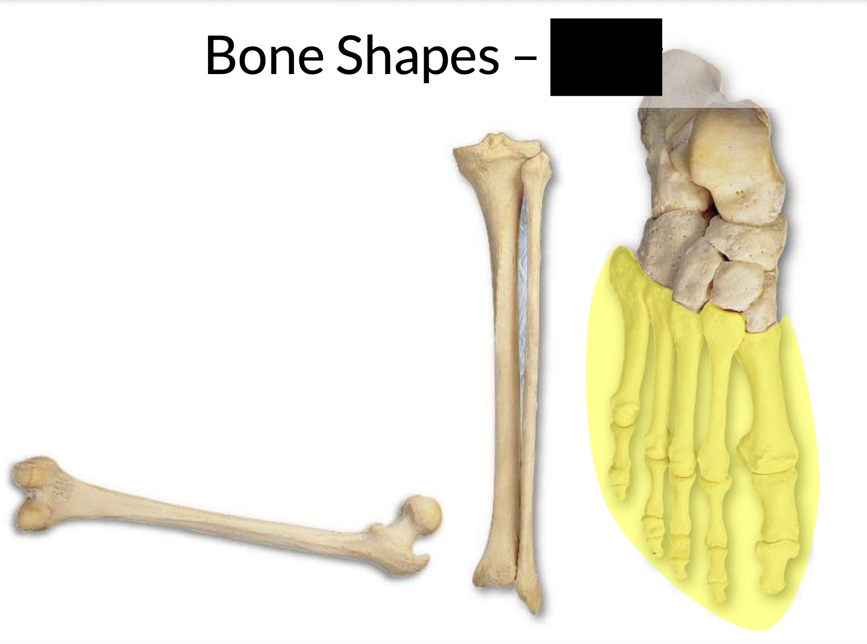 What bone shape is this?