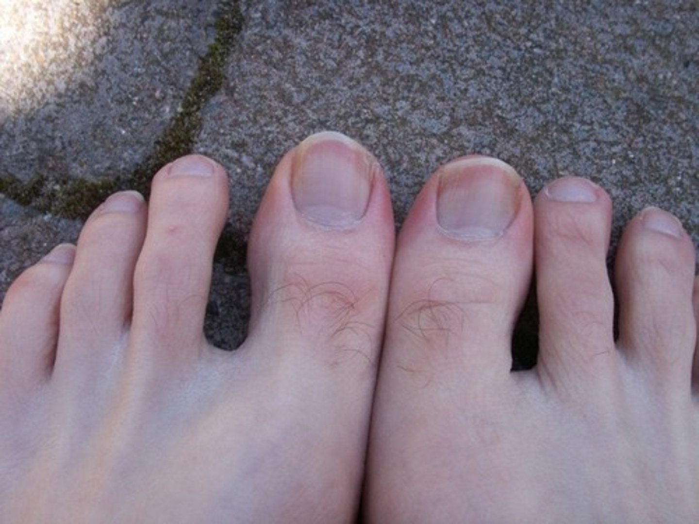 <p>toe / Ngón chân (Đực)</p>