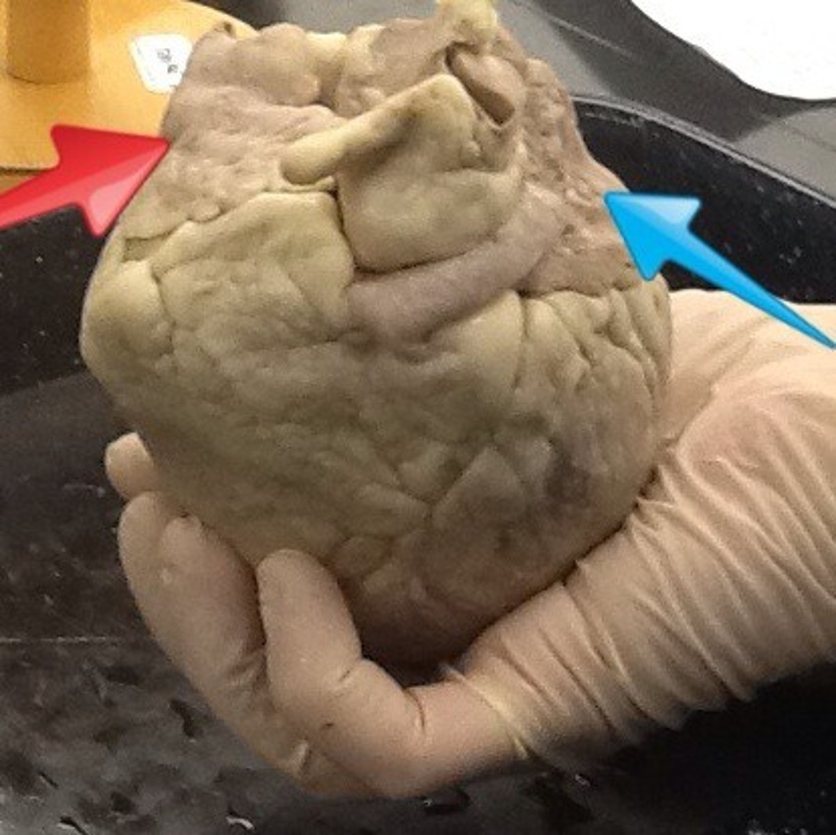 <p>Idenify What the RED arrow indicates</p><p>Identify what the BLUE arrow indicates</p><p>NOTE: Anterior view</p>