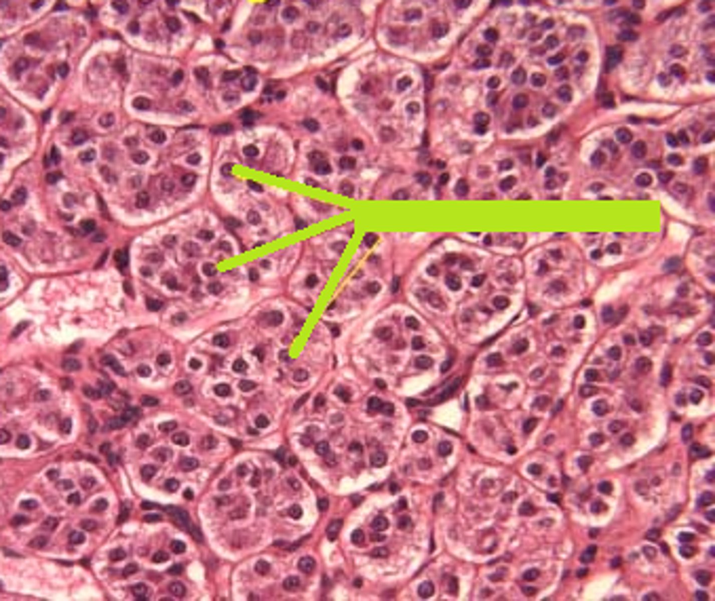 <p>How does the Adrenal Medulla appear?</p>