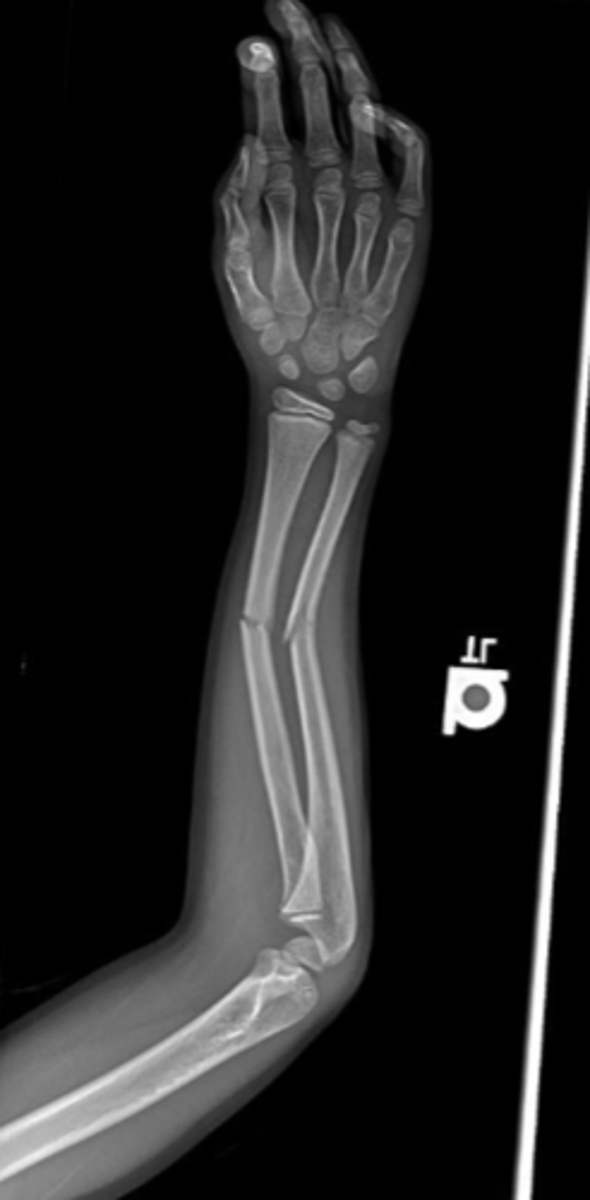 <p>Xray assessment</p>