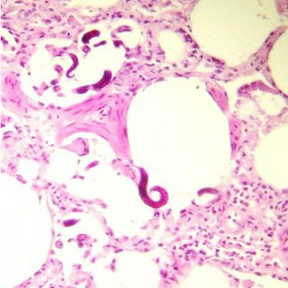 <p>Muellerius capillaris</p>