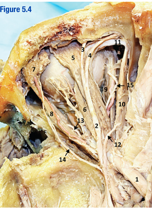 <p>Innervated by CN III involved in raising eyelid; Located just below the frontal n. (Include number in diagram)</p>