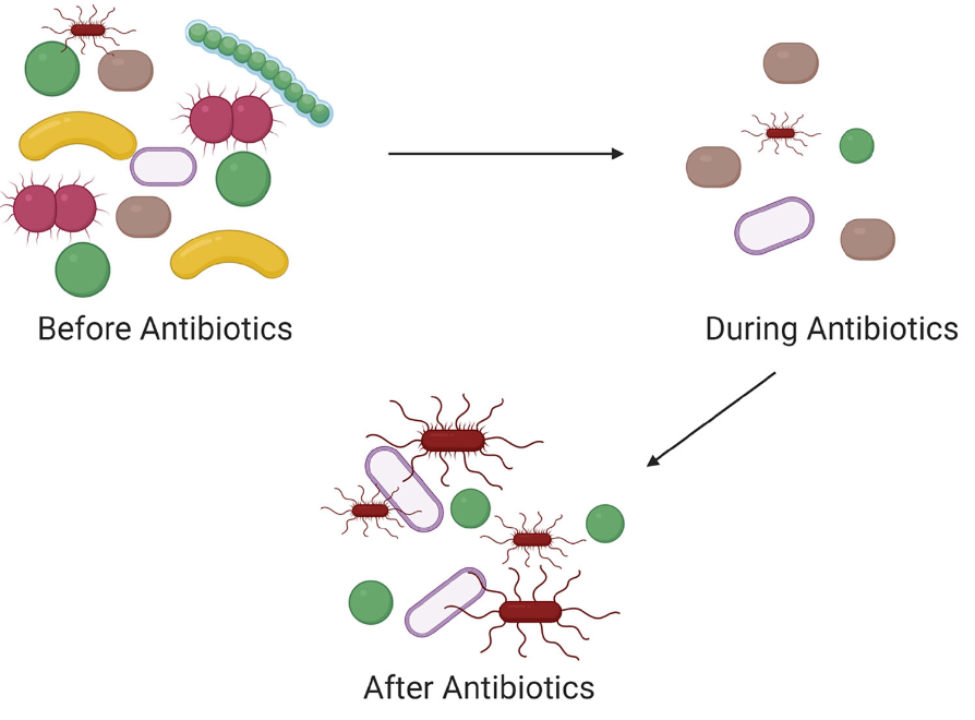 <p>oral antibiotics</p>