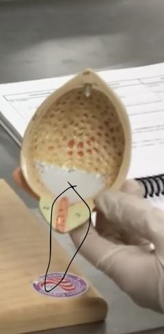 <p>Description: Duct draining the urinary bladder</p><p>Relationship: In females transports urine, in males transports semen and urine</p>