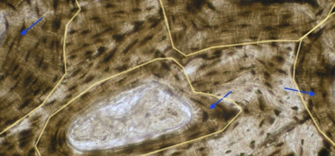 <p>What are the blue arrows of compact bone pointing to?</p>