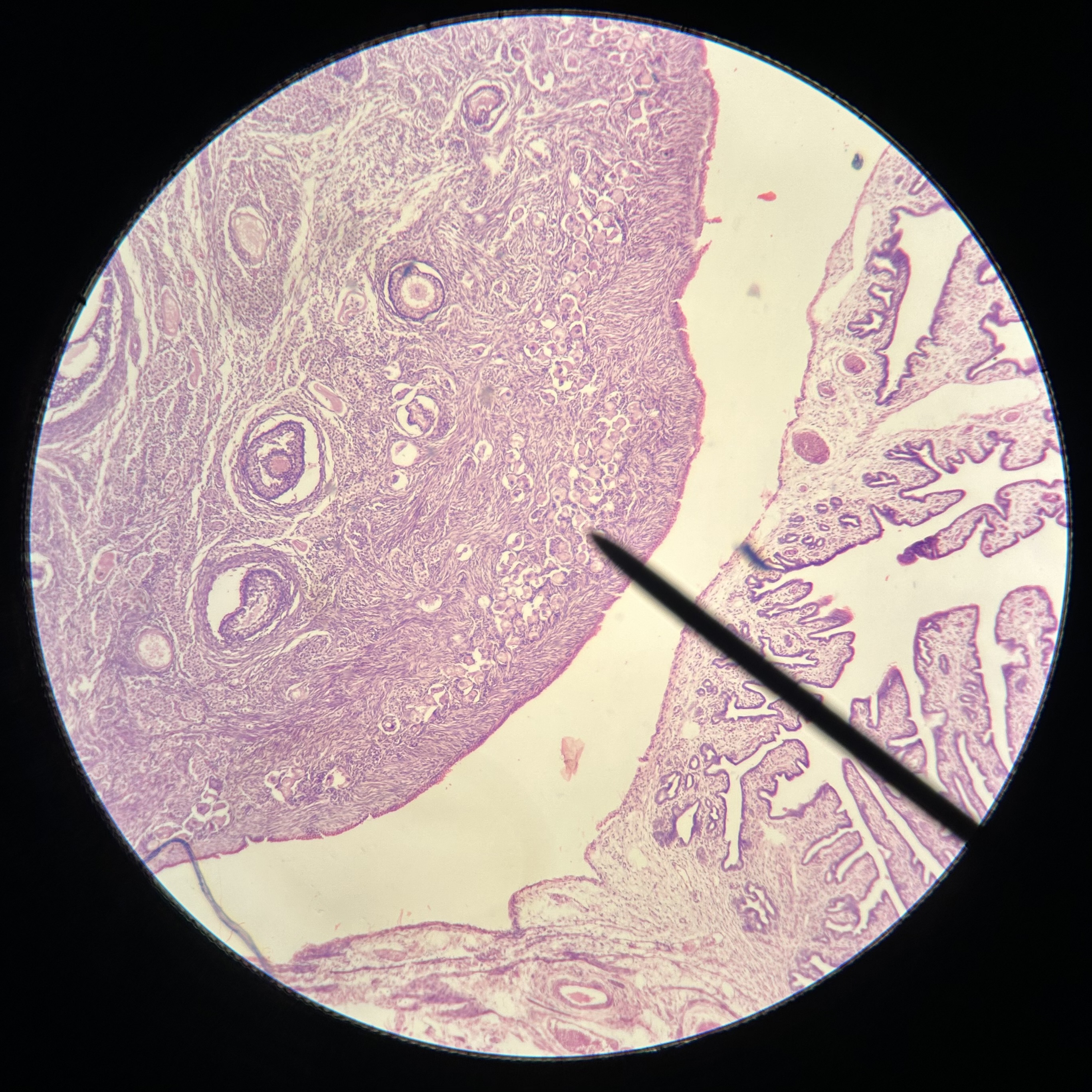 <p>What structure is shown (at pointer)?</p>