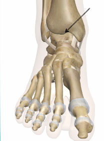 <p>Name joint</p>