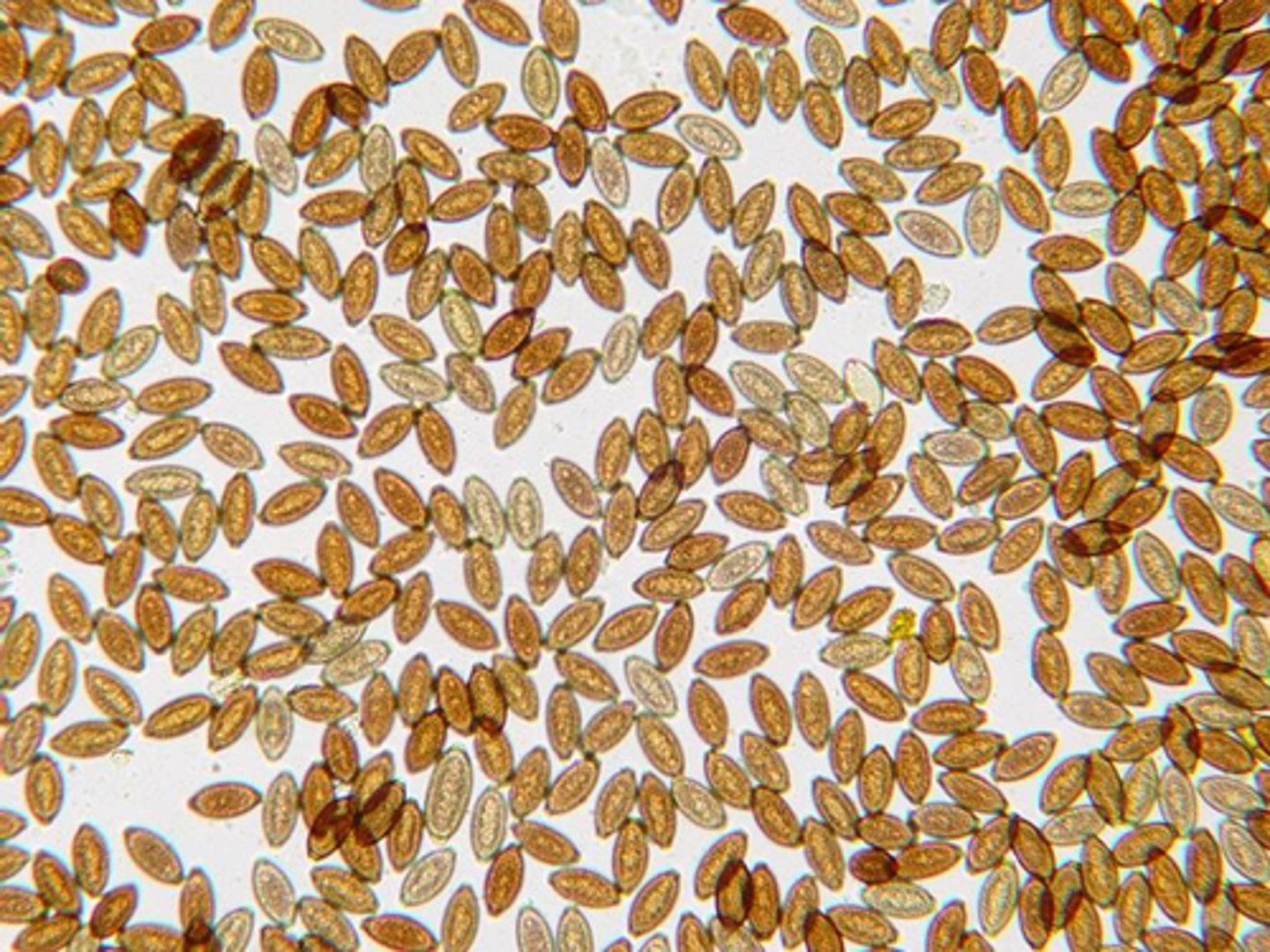 <p>Identify these eggs found on the fecal examination of an adult dog suspected of having Addison's disease. They measure approximately 80 x 40 um.</p>