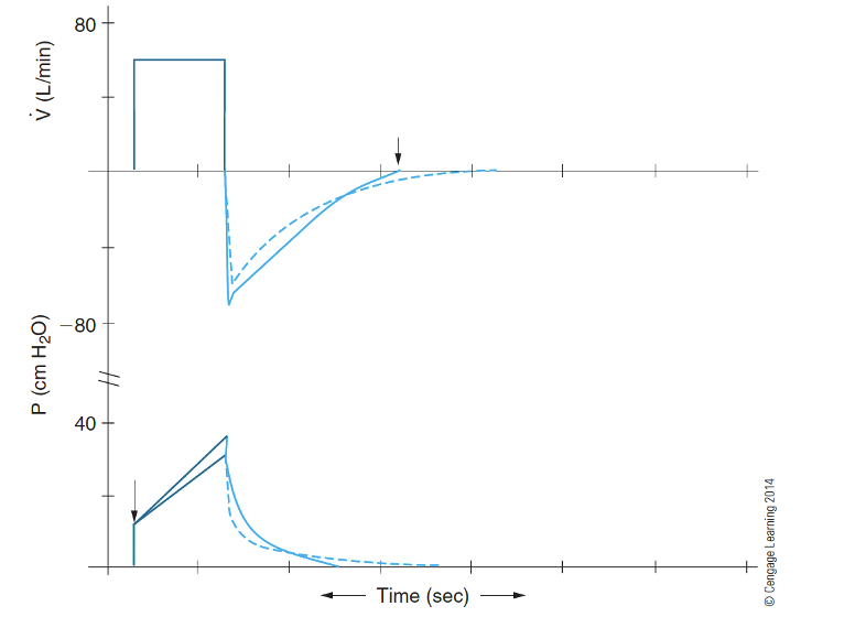 <p>What does decreased compliance look like? </p>
