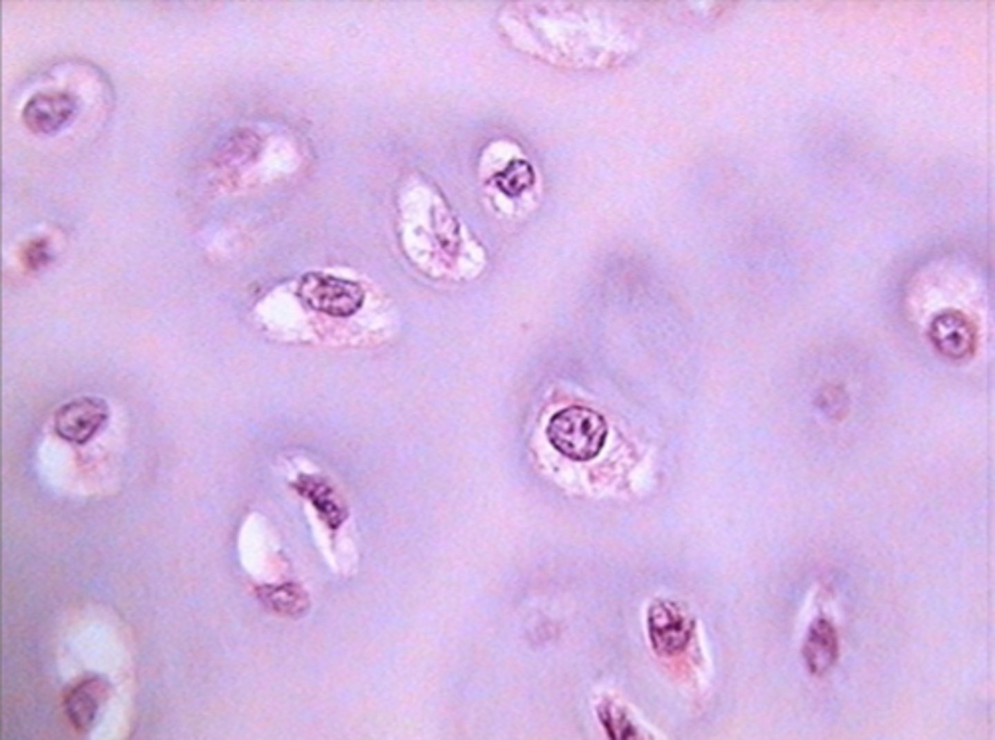 <p>Found at end of bones, meant to reduce friction between bones</p>