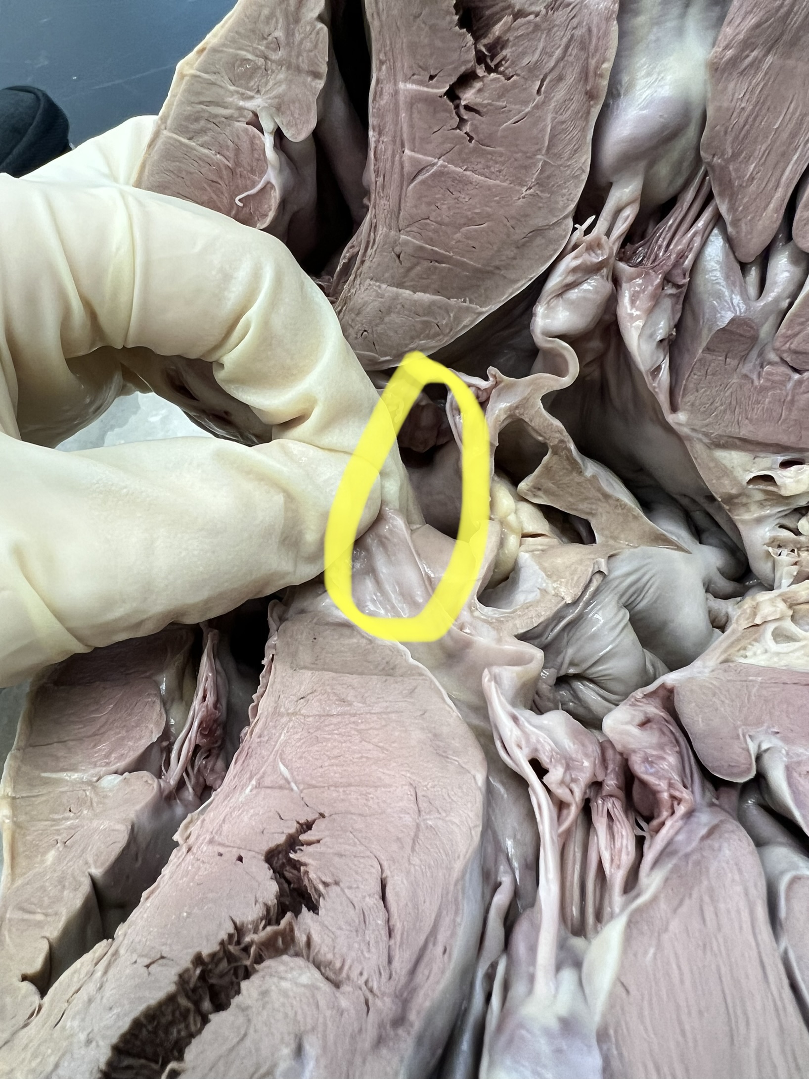 Name the heart structure.