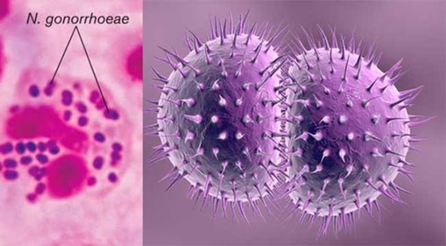 <p>Diplocoques : aspect en grain de café</p><p>Cocci gram -</p><p>Immobile, non sporulée</p>