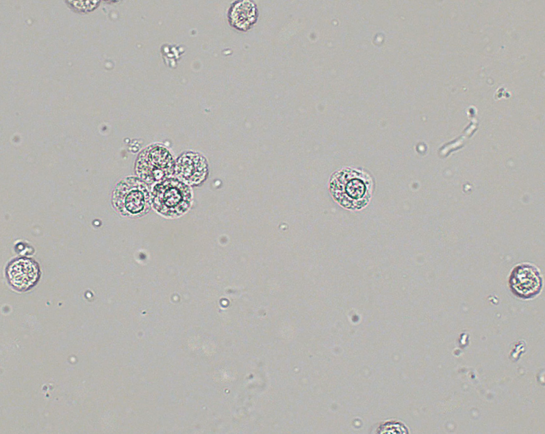 <p>Other term for Neutrophil; granules undergo brownian movement, producing sparkling appearance</p>