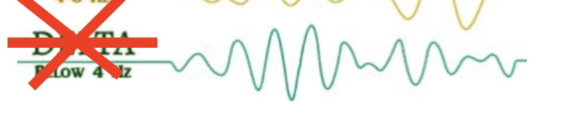 <p>What brain wave is this? Where is it present? </p>