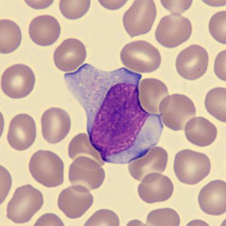 <p>What is this leukocyte showing?</p>