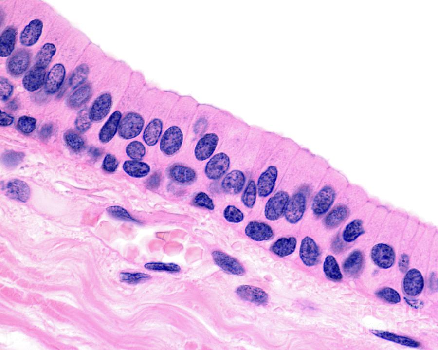 <p>Several cell layers; base cells usually cuboidal;</p><p class="p1">superficial cells elongated and columnar</p><p class="p1">-Protection; secretion</p><p class="p1">-small amounts in male urethra and large ducts of some glands</p>