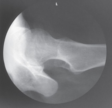 <p>What is the projection and anatomy shown in this image?</p>