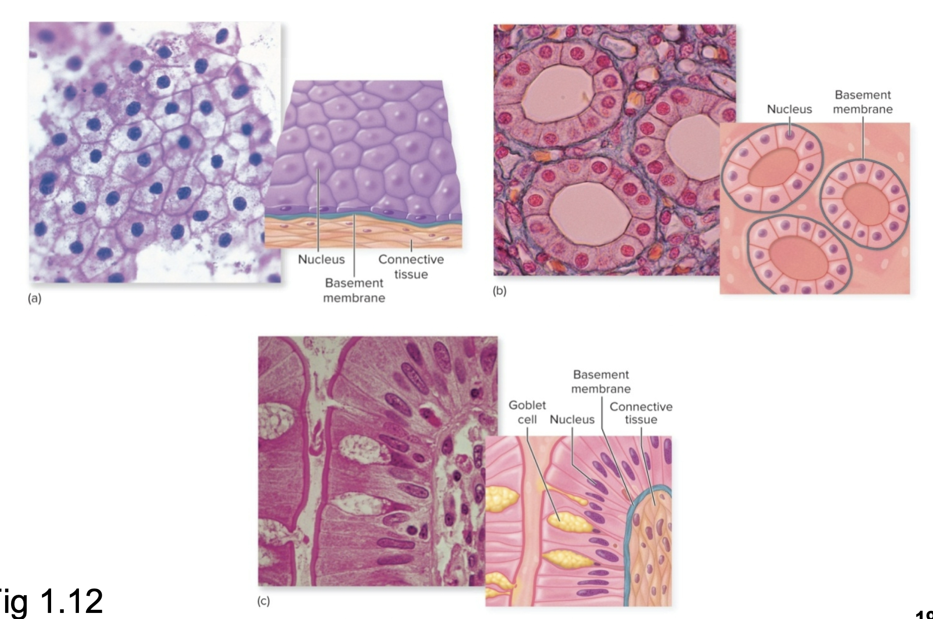 <p>What type of tissue is this?</p>