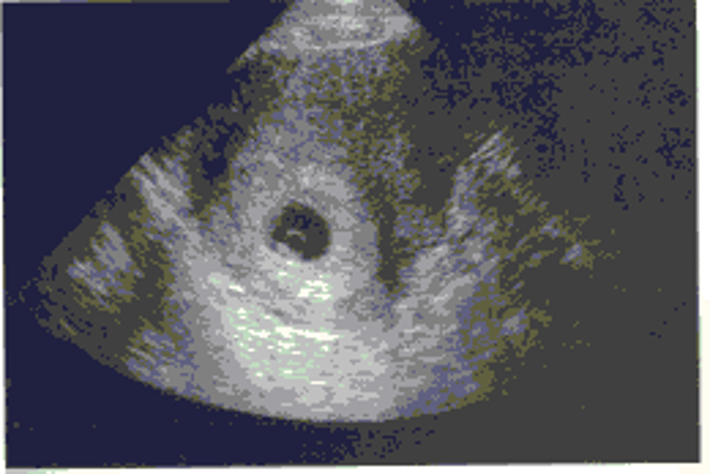 <p>nhất quán, đồng tình </p>