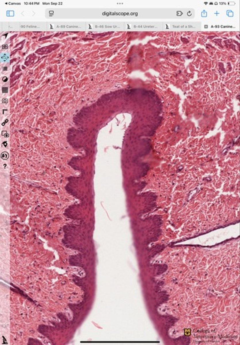 <p>What epithelium type is shown?</p>
